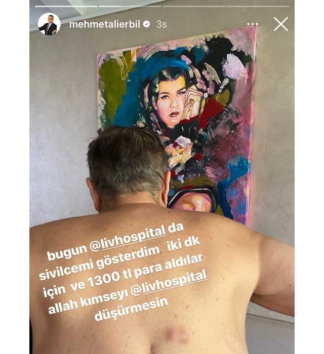 mehmet ali erbil sivilcesi icin odedigi paraya isyan etti (7)